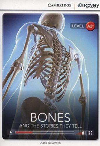 A2+ Bones: And the Stories They Tell (Book with Online Access code) Interactive Readers