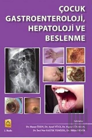 Çocuk Gastroenteroloji, Hepatoloji ve Beslenme