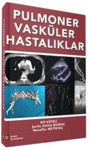 Pulmoner Vasküler Hastalıklar | Kitap Ambarı